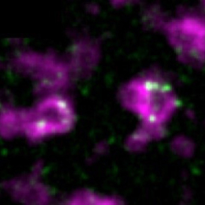 Cellules vues en microscopie avec marqueurs